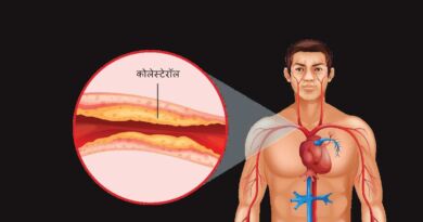 कोलेस्टेरॉल वाढण्याची कारणे - Causes of Cholesterol In Marathi