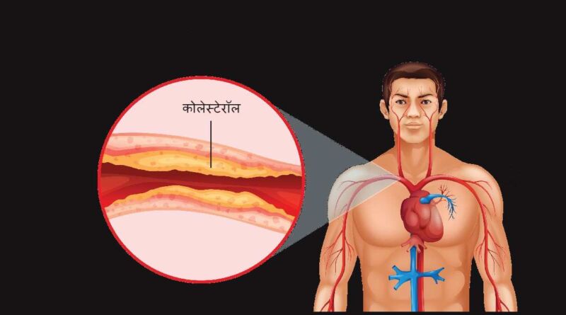 कोलेस्टेरॉल वाढण्याची कारणे - Causes of Cholesterol In Marathi
